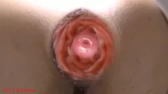 Play Public Toilet Anal Prolapse: Peeing MILF's Gaped Asshole